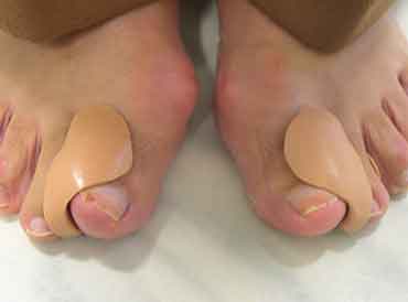 orthoplasties