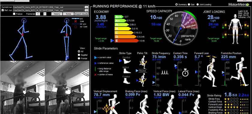 podologie pour sportif